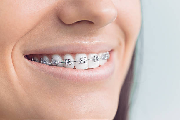Best Veneers and Lumineers  in Troutdale, OR